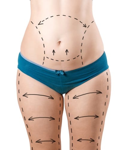 Belt For Tummy Tuck - Flank Or Abdominal Liposuction